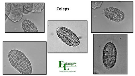  Coleps: Unveiling the Mystery Behind These Tiny Ciliates That Are Both Free-Swimming and Sessile!