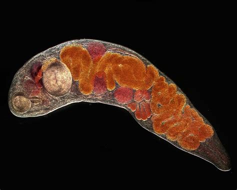  Yellow-Eyed Trematode:  This Remarkable Parasitic Worm Thrives Within Its Freshwater Snail Host!